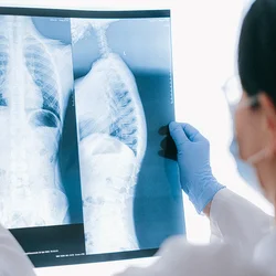 A doctor looking at a chest x-ray.